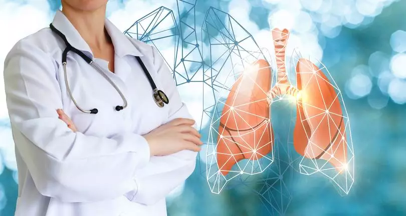 Pneumologie-Galati-250x133 Doctor shows human lungs .